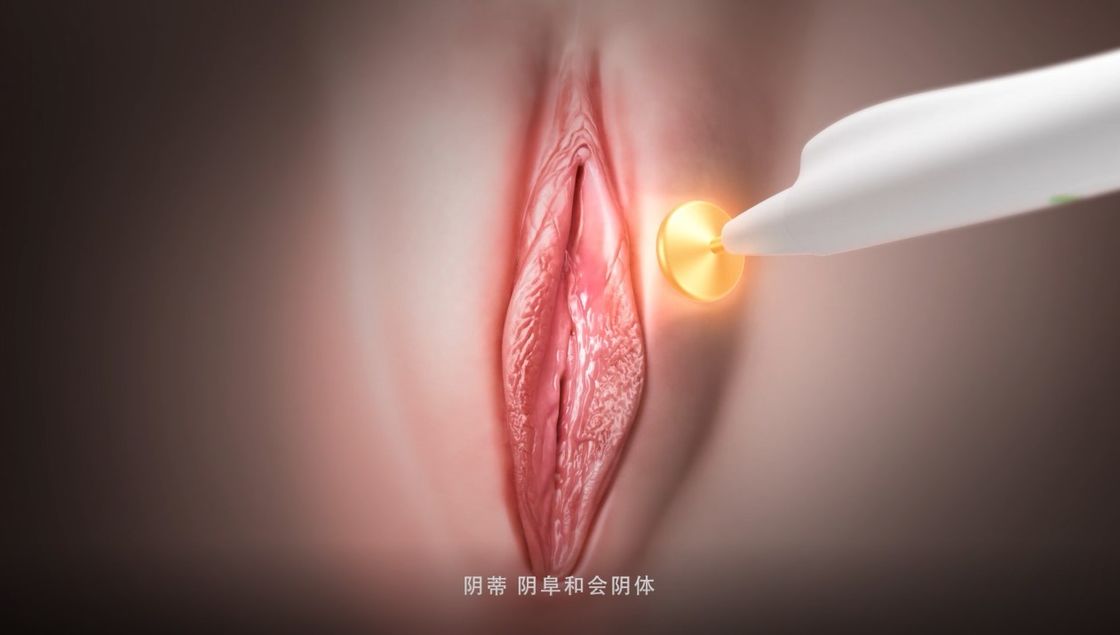 Female RF Vaginal Rejuvenation Thermage Vulva Rejuvenation Laser Urinary Incontinence